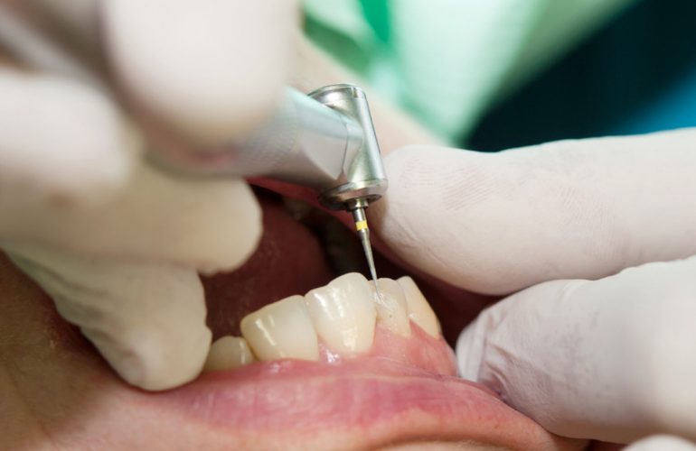 Aesthetic Dental Restorative Dentistry